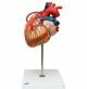 Anatomisches Modell Herz mit Bypass ST-ATM 74